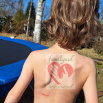 Schürfwunde am Rücken